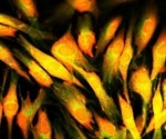 Choosing The Correct Camera for Fluorescence Microscopy