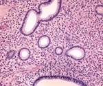 Prevention and treatment of endometrial hyperplasia
