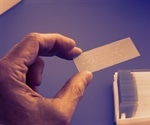 Protein Microarray Challenges
