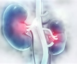 Ureteric Calculi