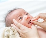Gingival Cysts in Newborns