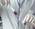 Solutions from Avantes for Medical and Biomedical Applications