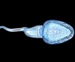 Clinical trial of traditional Chinese medicine for the treatment of male infertility