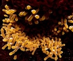 Treating Nontuberculous Mycobacteria (NTM)