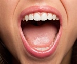 Oral Microbiota