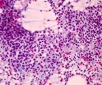 endTB-Q trial highlights importance of individualized regimens