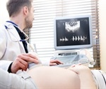 Vanderbilt to introduce focused ultrasound for treating essential tremor and Parkinson's disease