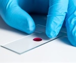 Engineered protein shown effective in patients with severe von Willebrand disease