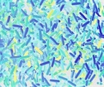 How Does the Diet Impact Microbiota?