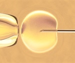 Serious health problems related to late preterm births