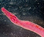 WHO marching toward extraordinary progress against neglected tropical diseases, report reveals
