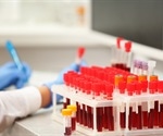 rVWF safe in patients with type 3 and severe type 1 von Willebrand disease, suggests interim study data
