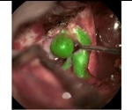 Leica Microsystems introduces new augmented reality imaging technologies for surgical microscopes