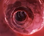 High fiber diet helps protect against dangerous gut infections