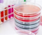 Low-cost diagnostic tool delivers COVID-19 test results in under an hour