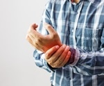 Myopenia identified as key contributor to muscle loss in rheumatoid arthritis