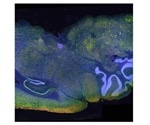 Leica introduces new DMi8 S solution for fast, versatile microscopic imaging of living cells