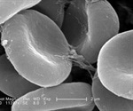Types of Electron Microscopes