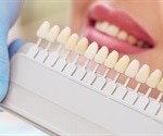 DIY tooth whitening kits can be dangerous