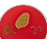 High Quality Blood Agar Production Using DOSE IT and MEDIA JET