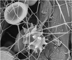 Integrated CLEM and Scanning Electron Microscopes Help Gain New Insights into Blood Disorders