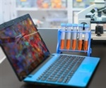 Advances in Digital Pathology