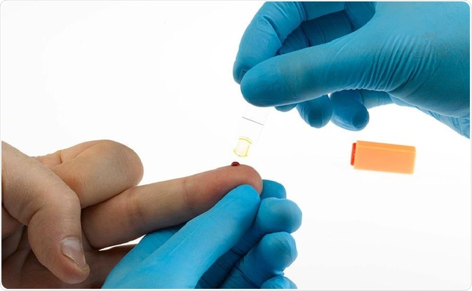 Finger prick test