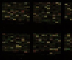 Extraction of  RNA from Archived Formalin-Fixed, Paraffin-Embedded Tissue