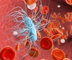 Sepsis Prevention