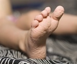 Why Does Skin Go Wrinkly in Water?
