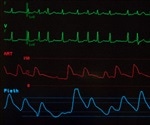 Working for many hours each day can increase risk of heart problems