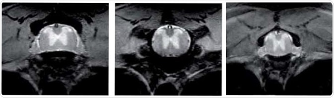 Mouse Spine lmaging