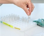 Non-Targeted Metabolomics