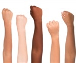 Skin Phototypes
