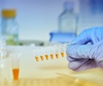 Advances in Metabolomics Research