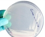 Multi-drug resistant fungi found in UK hospitals - alarms health officials