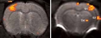 BOLD activation at 11.7 Tesla using the quadrature surface coil with a resolution of (left) 300 x 300 x 2000 μm3 for high quality and (right) 150 x 200 x 2000 μm3 for high sensitivity.