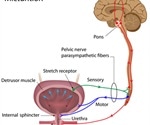 Managing Neurogenic Bladder