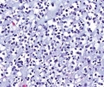 Genetically Engineering Rat Gliomas to Enable Clinically Relevant Imaging of Human Glioblastoma