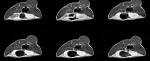 Nanoparticles in MRI For Improving Contrast Agents