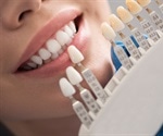 Patient Care for Dental Crowns