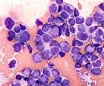 Types of Blood Cancer