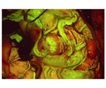 Leica Microsystems receives first FDA clearance for its FL560 fluorescence microscope filter