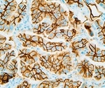 Using microCT to Research Targeted Approaches to Triple-Negative Breast Cancer