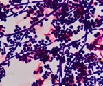 Understanding molecular mechanisms and metabolic pathways of yeast for drug discovery