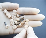 Advantages and Disadvantages of Dental Crowns