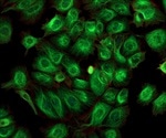FRET and Yeast Two-Hybrid Systems Compared