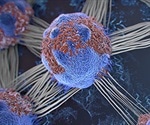 New precision medicine approach for metastatic pancreatic cancer