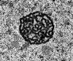 Sample Preparation in TEM