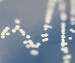 Two Hybrid Screening: Advantages and Disadvantages